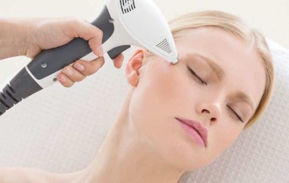 Achieving Even Skin Tone with IPL Treatment