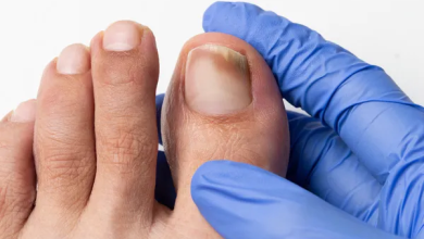 How to Heal a Toe Infection and Prevent Future Infections