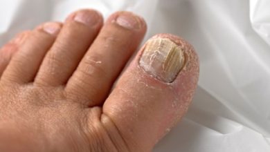 What Home Remedies Work for Pus Under the Toenail