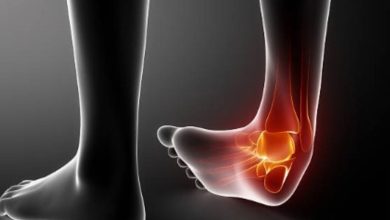 What Is An Osteotomy Foot Procedure