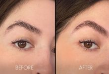 Why Choose Foot and Ankle Center of Arizona for Brow Lamination