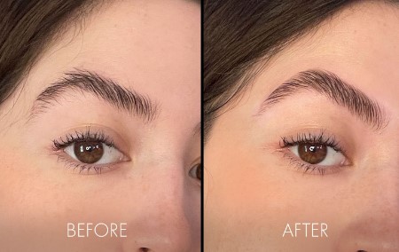 Why Choose Foot and Ankle Center of Arizona for Brow Lamination