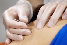 dry needling therapy clinic in Lahore